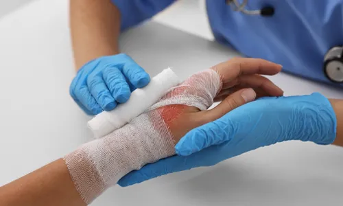 Skin Grafts and Flaps