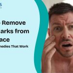 how to remove injury marks from the face