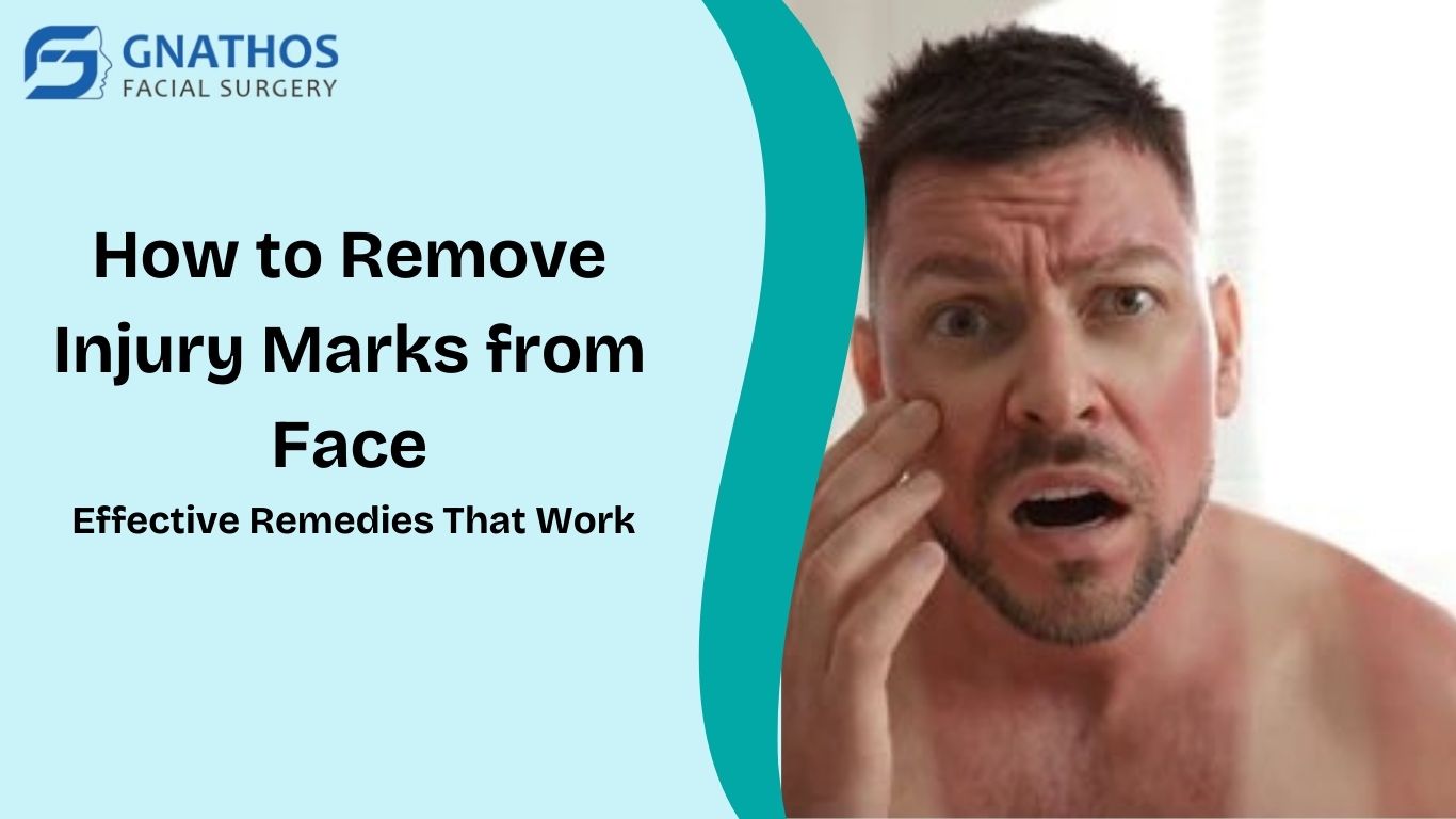 how to remove injury marks from the face