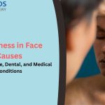 Numbness in Face Causes